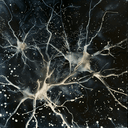 Engineered Immunotherapy Improves Treatment for Brain Cancer