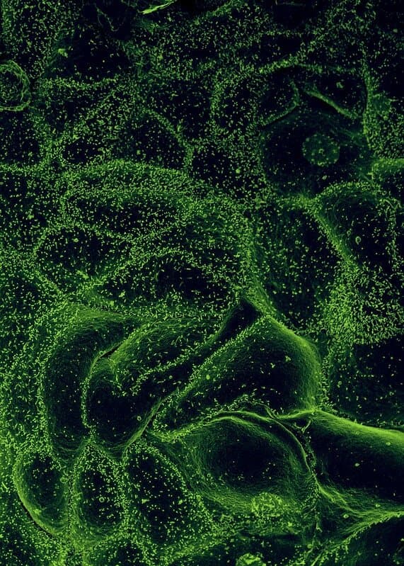 US activates highest-level response to Ebola outbreak